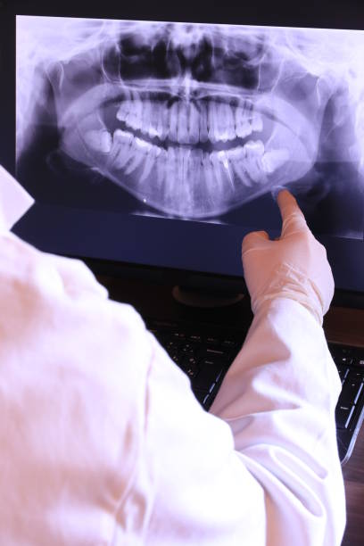 Best Emergency Treatment for Dental Infections or Abscesses in Columbiana, AL