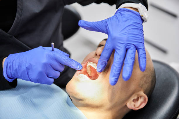 Best Emergency Gum Treatment in Columbiana, AL